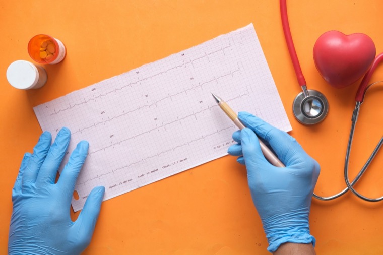 Trazado de electrocardiograma siendo revisado con guantes clínicos